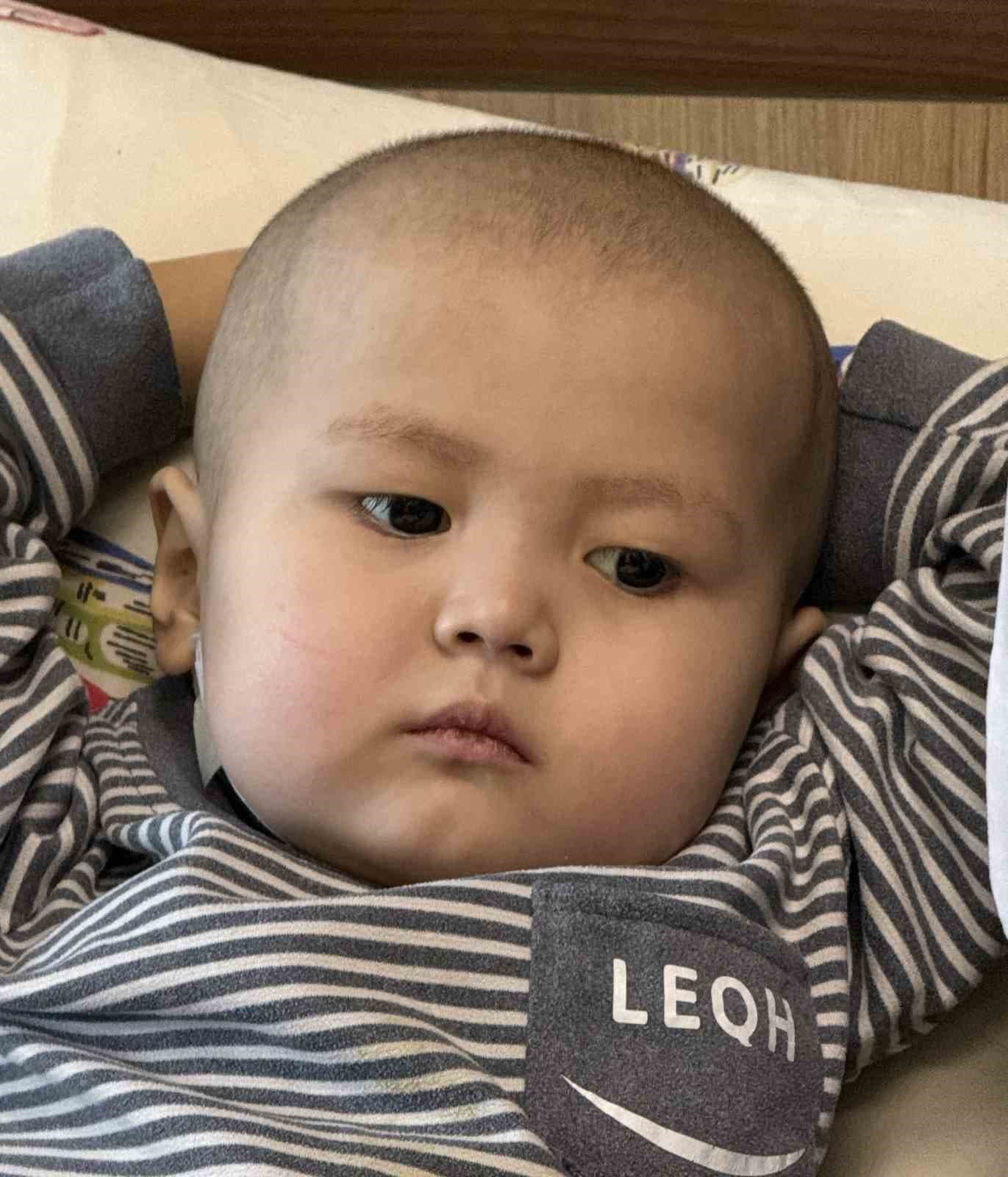 Türk kadın hekimin karaciğer nakliyle 3 yaşındaki Nuryiğit hayata tutundu