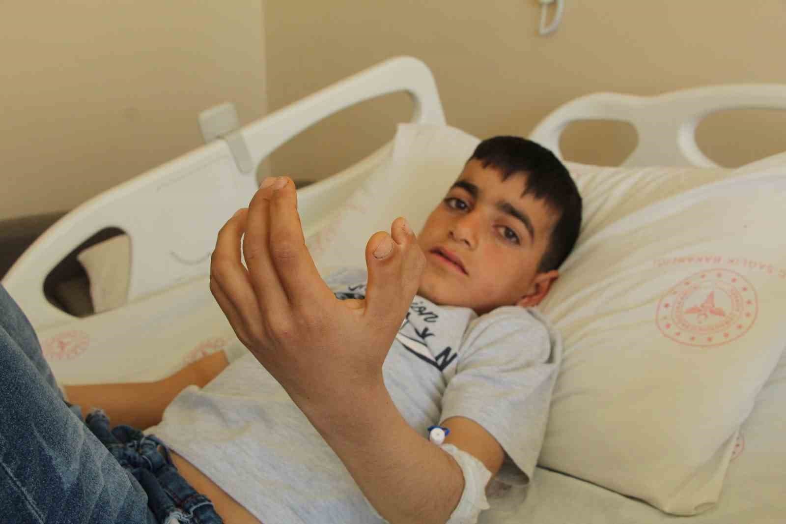 Şırnak’ta yapışık parmaklı iki kardeş ameliyatla sağlıklarına kavuştu