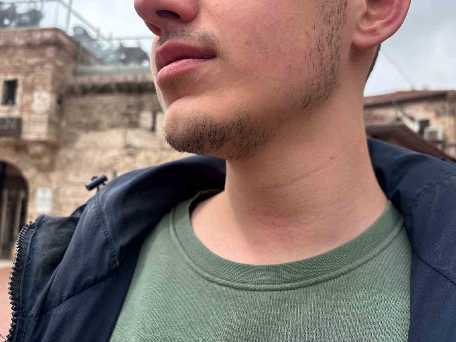 Bolu’da haber takibi yapan muhabir darbedildi