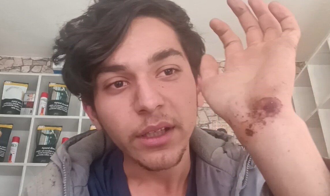 Virajı alamayan Fiat Tofaş takla attı, korku dolu anlar araç içi kamerasına yansıdı