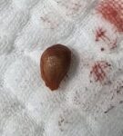 Yuttuğu karayemiş çekirdeği az kalsın öldürüyordu