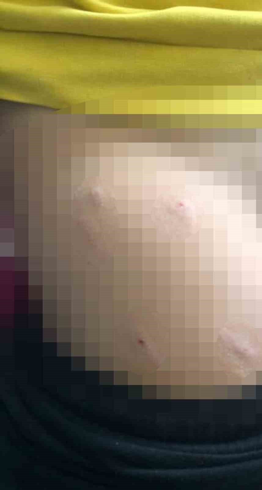 Sokak köpeği 5 yaşındaki çocuğa saldırdı