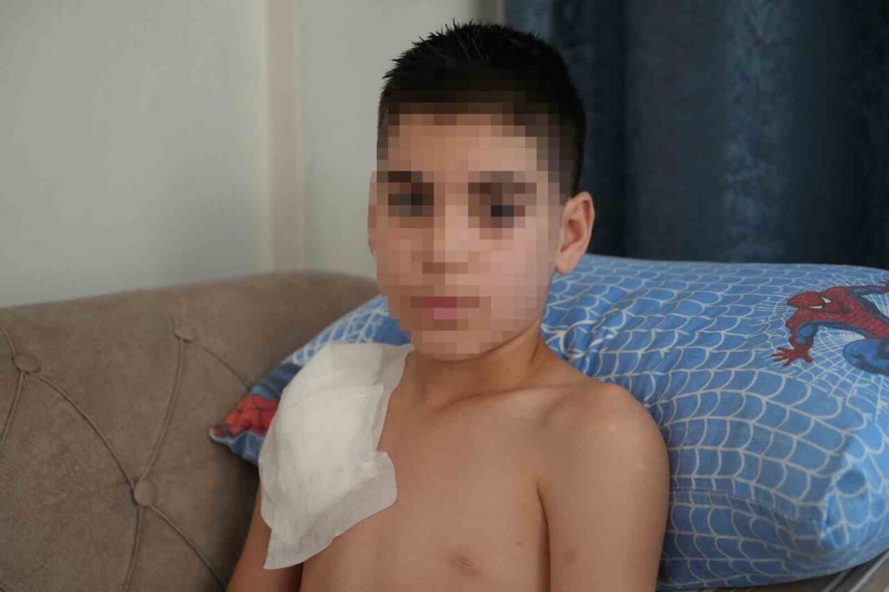 Vücudu köpek tarafından parçalanan Yunus’un kolu kullanılamaz hale geldi, aile adalet arıyor