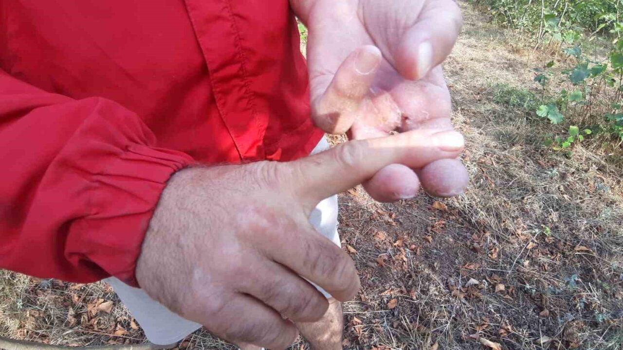 Ayının saldırısına uğrayan çiftçi dehşet anlarını anlattı: "Parmağımı kopardı"