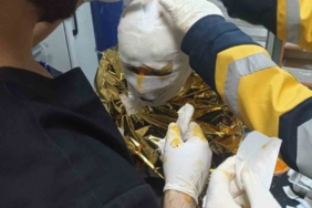 Erzincan’da kömür ocağında yangın: 2 işçi yaralı