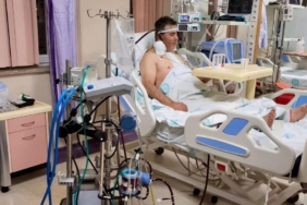 Kalp ameliyatında ECMO başarısı, bir ilk oldu