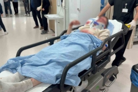 Polisten kaçan motosiklet sürücüsü kaza yaparak yaralandı