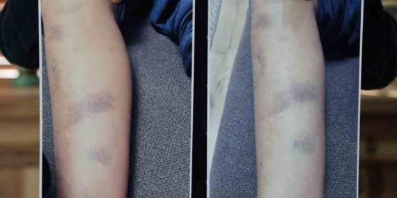 Diyarbakır’da özel okulda 8 yaşındaki çocuğun darbedildiği iddiası