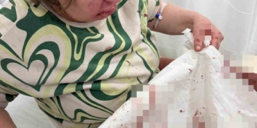 Komşusunu darp eden sivil memur hakkında soruşturma açıldı