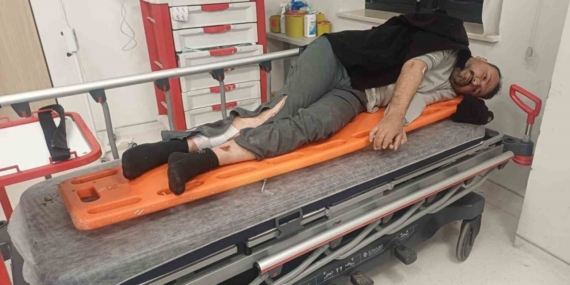 Osmaniye’de çöp kamyonuyla otomobil çarpıştı: 1 yaralı