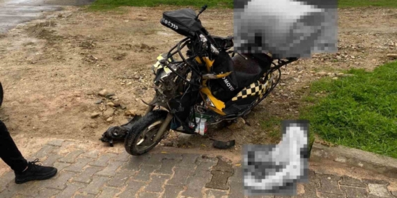 Sinop’ta kaza: 1 yaralı