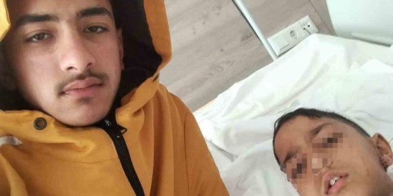 Ankara’da sokak köpeğinin saldırısına uğrayan çocuk yaralandı