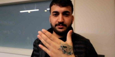 Dövme sildirmek isterken kabusu yaşadı, elindeki dokular öldü