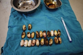 Midesinde taşıdığı uyuşturucu maddeler polisin dikkatinden sayesinde ele geçirildi