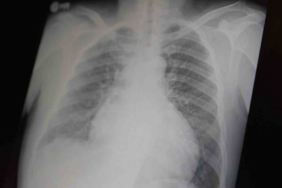 Profesör açıkladı: "Metamfetamin ve kokain gençler arasında tehlikeli boyutlara ulaştı"